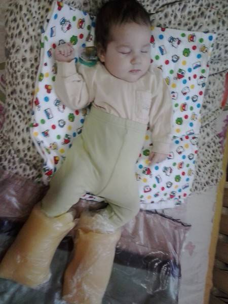 Парафиновые сапожки в домашних условиях - советы врачей