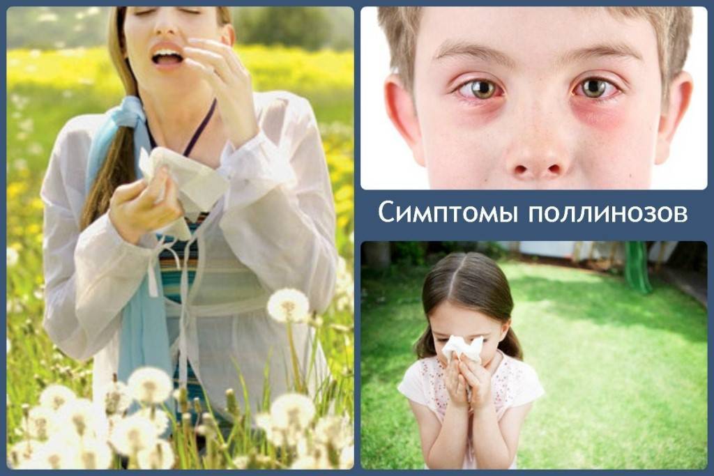 Аллергия на цветение у ребенка