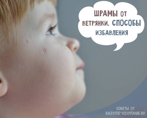 Как быстро убрать глубокие старые шрамы на коже: можно ли это сделать, возможно ли избавиться от красноты, красных следов и темных рубцов на теле после операции
