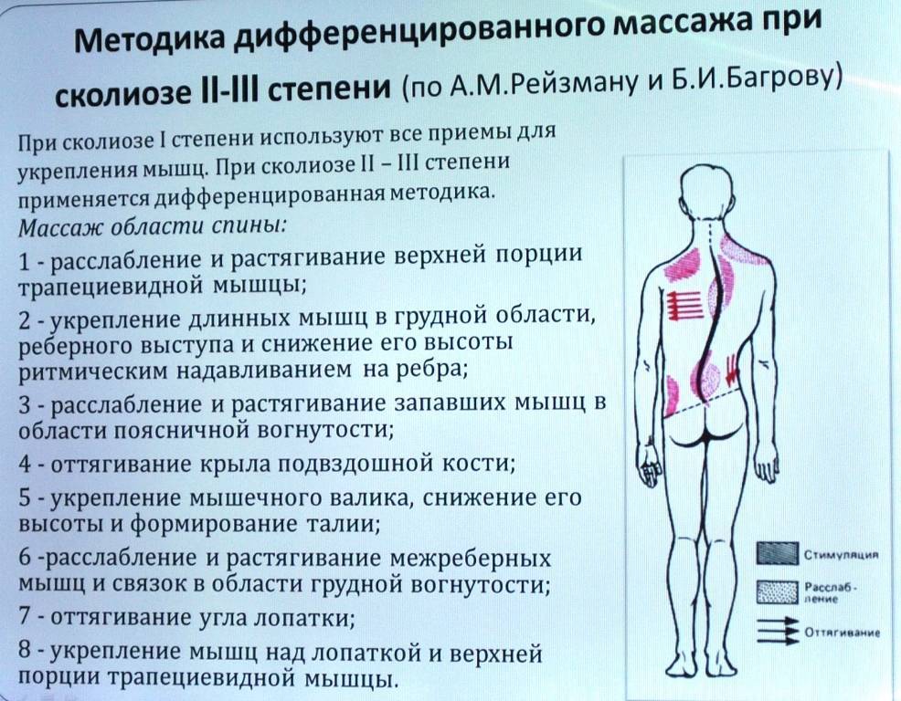 Тейпирование при сколиозе у детей схема лечения