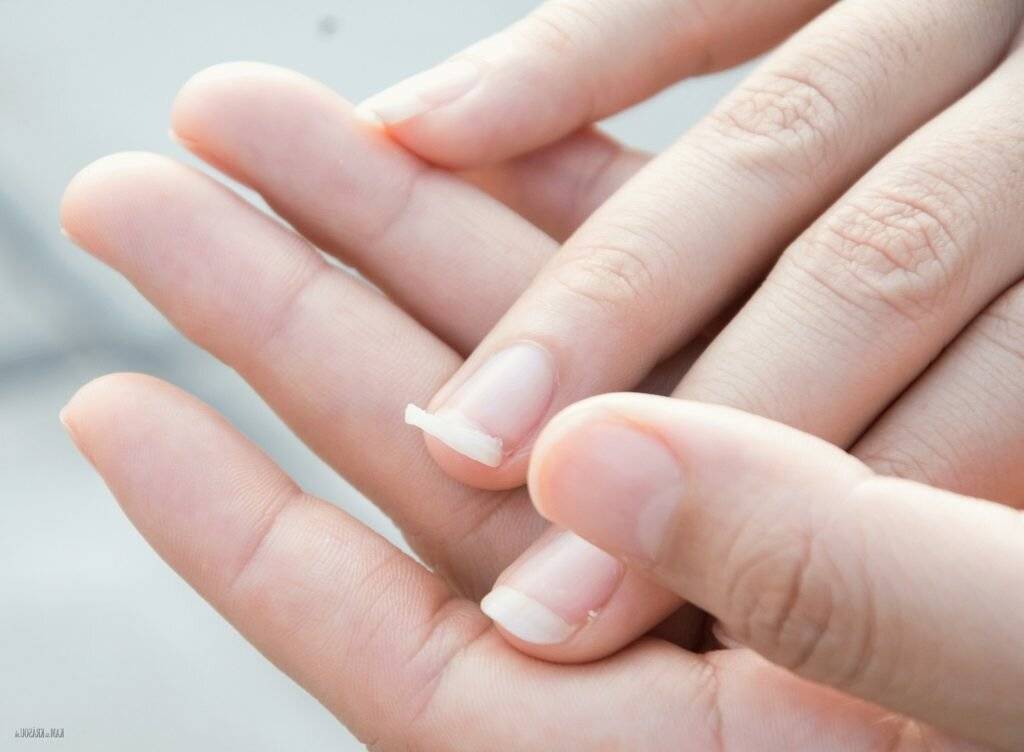 Ребенок грызет ногти, что делать?