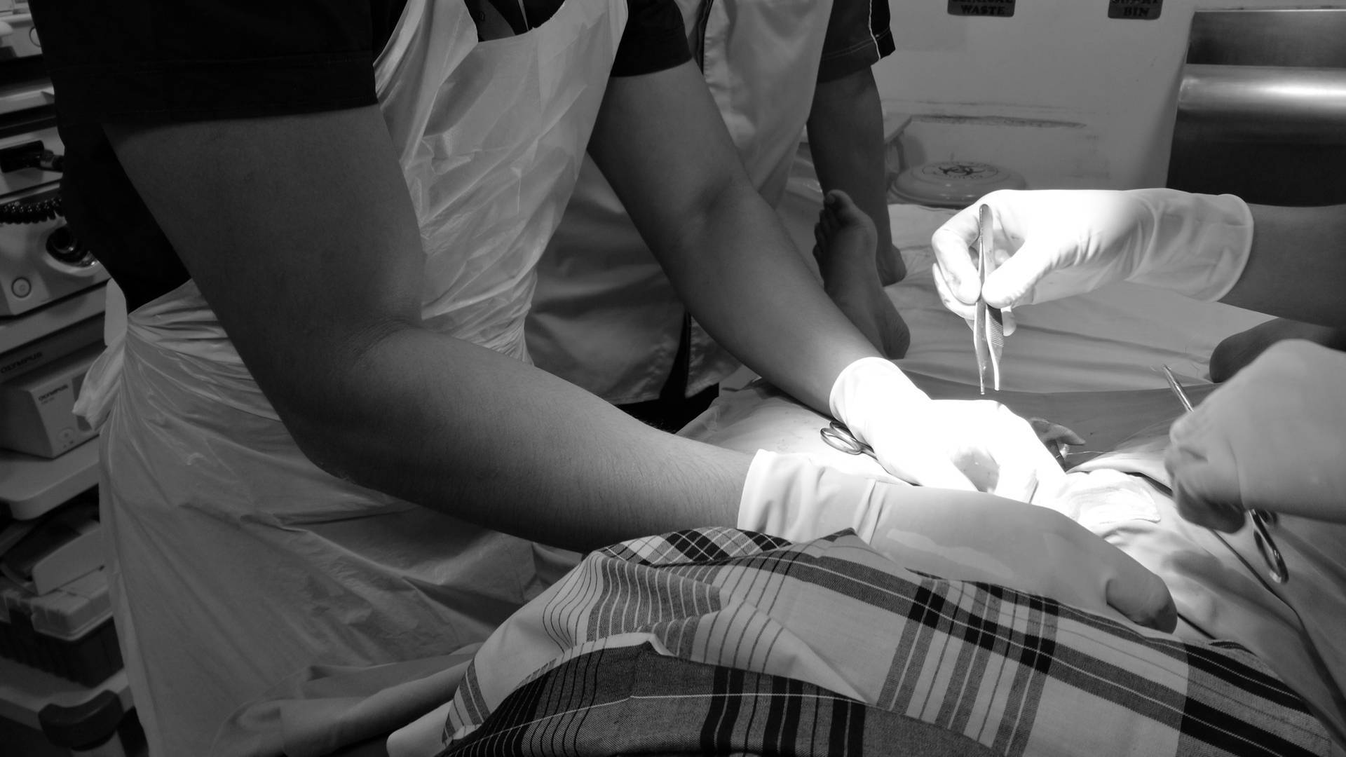 Старые и новые методики обрезания крайней плоти - неомед 249-0-249