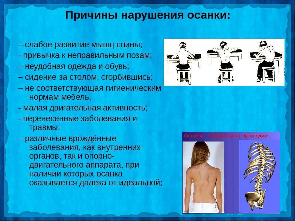 Лечение сколиоза и нарушений осанки у детей