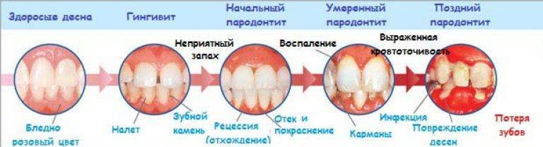 Прорезывание зубов – как помочь ребенку и не сойти с ума родителям