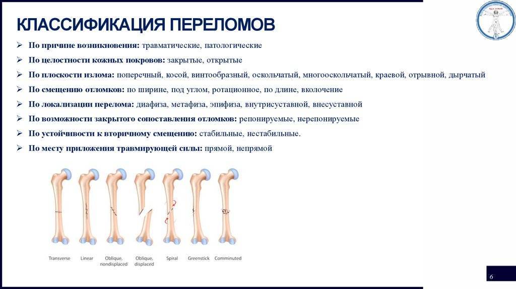 Перелом кости может быть каким. Классификация переломов костей конечностей. Рентгенологическая классификация переломов костей. Классификация переломов по линии излома. Классификация переломов оскольчатый.