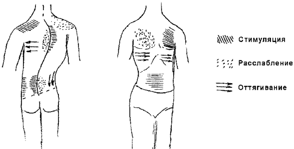Массаж при сколиозе картинки