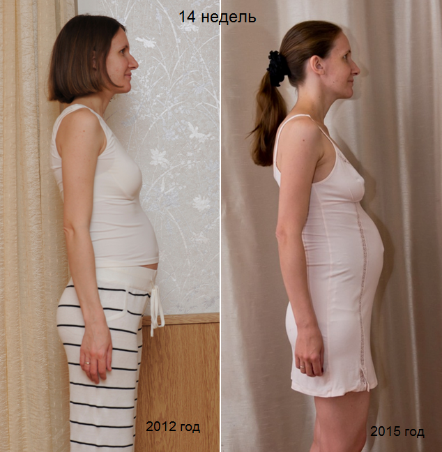 Когда начинает расти грудь при беременности: на каком сроке