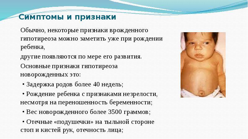Гипотиреоз у детей