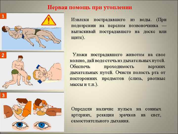 Оказание первой помощи пострадавшему на воде