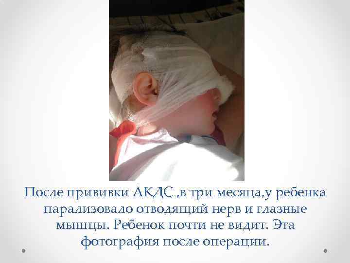 Прививка акдс: побочные эффекты у детей, реакция и последствия