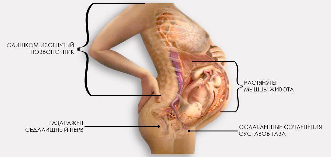 Болит промежность при беременности. причины болей в промежности во время беременности — беременность. беременность по неделям.
