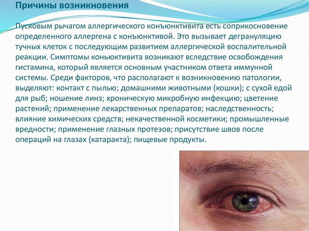 Глазные капли от конъюнктивита: правила использования, условия хранения