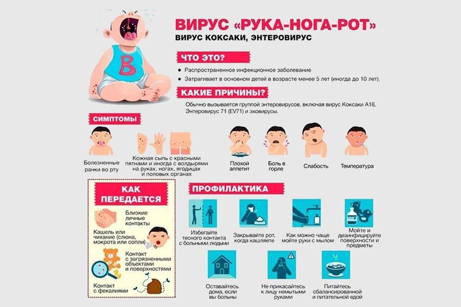 Вирус коксаки: симптомы у взрослых и детей, лечение, инкубационный период - medside.ru