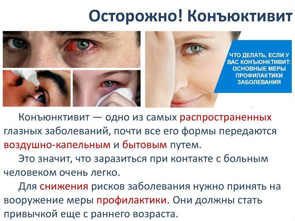 Покраснение глаз | частые заболевания, при которых краснеют глаза
