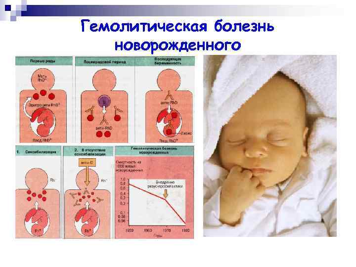 Гемолитическая болезнь новорожденных
