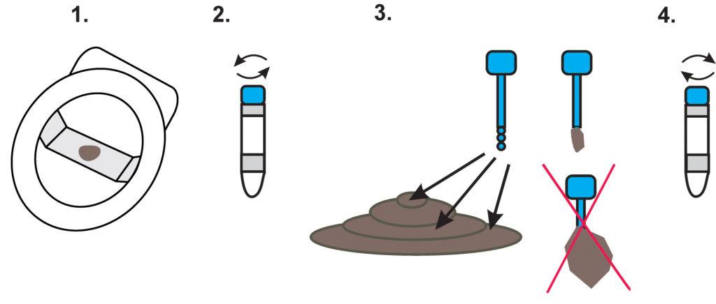 Копрограмма в детском возрасте: 9 показаний к проведению, правила сбора материала, нормальные и патологические показатели