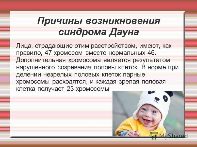Cиндром дауна (трисомия 21): признаки при беременности, причины почему рождаются дети с синдромом дауна - medside.ru