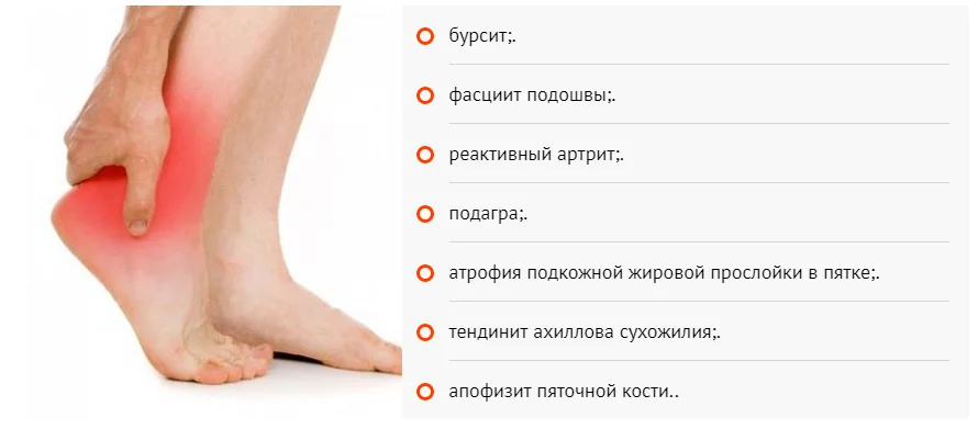 Боль в ногах (лодыжках, ступнях, пальцах ног). что делать при боли в ногах, причины боли в ногах.!