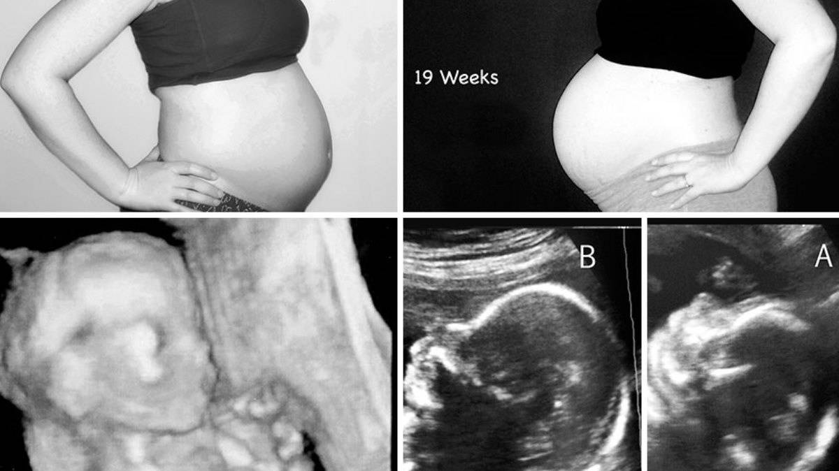 19 недель беременности расположение плода фото