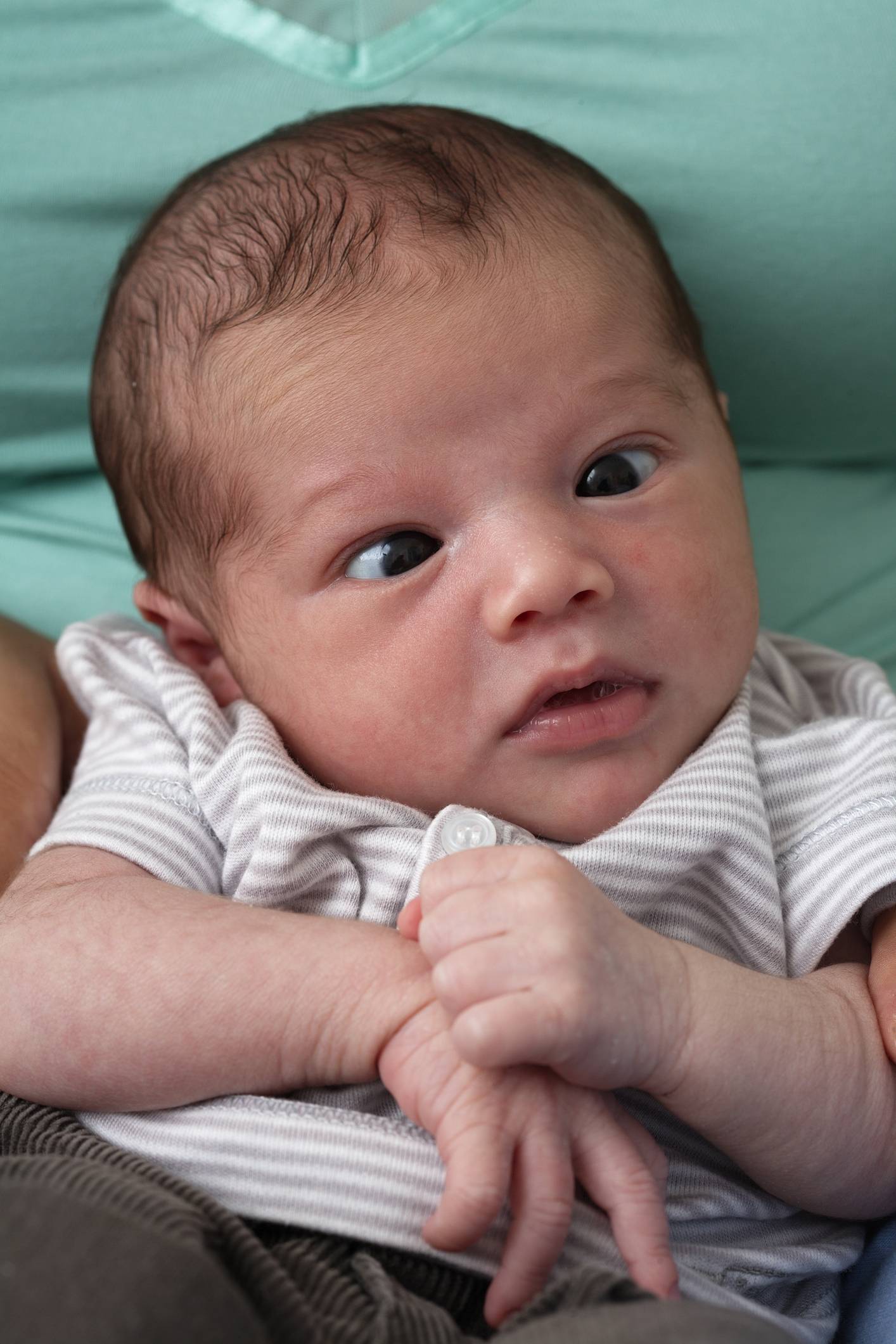 Косоглазие у новорожденных: причины, когда проходит у грудничков, лечение
