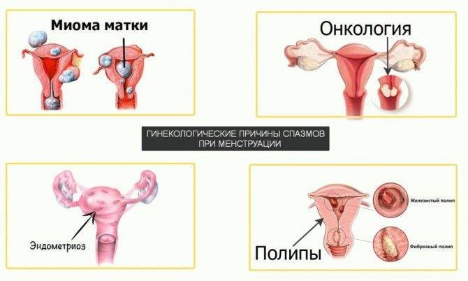 Как отличить пмс от беременности – признаки предменструального синдрома и беременности, в чем разница — медицинский женский центр в москве