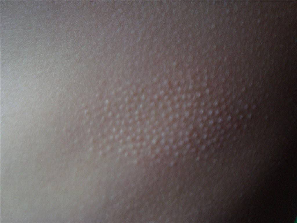 Почему шелушится кожа у ребенка: причины, симптомы и диагностика