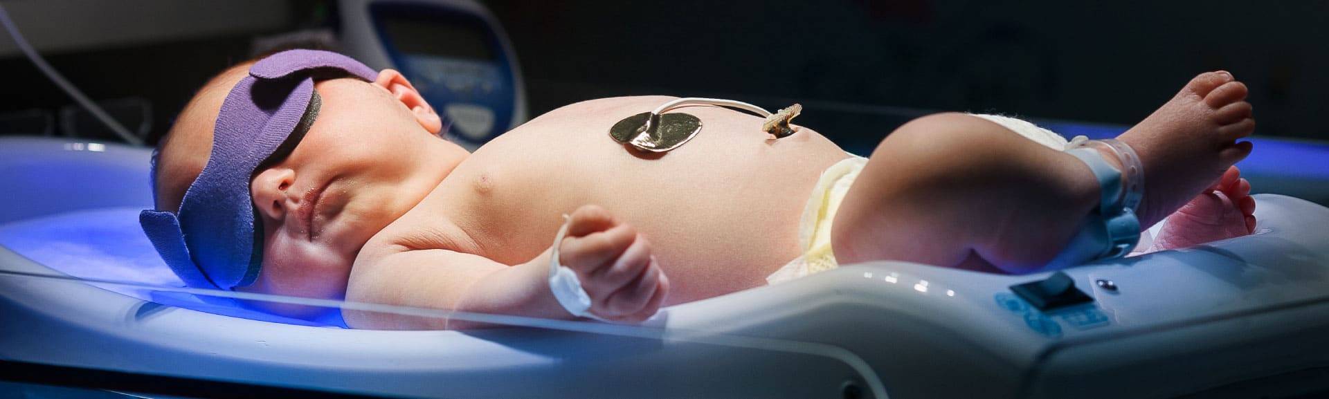 Традиционная фототерапия новорожденных