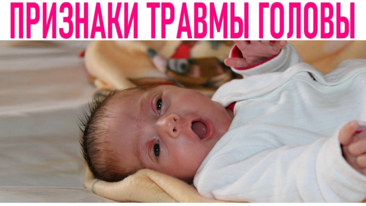 Ребенок упал и ударился головой: что делать?   | материнство - беременность, роды, питание, воспитание