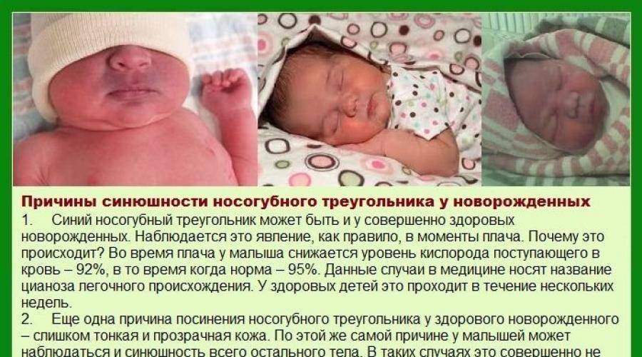 Почему у новорожденного может быть. Синюшностью носогубного треугольника. Цианоз носогубного треугольника у новорожденных. У ребенка синеет носогубный. У новорожденного синеет носогубный треугольник.
