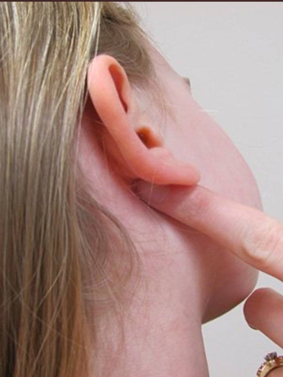 Золотуха за ушами у грудничков и детей от года: причины, симптомы и лечение