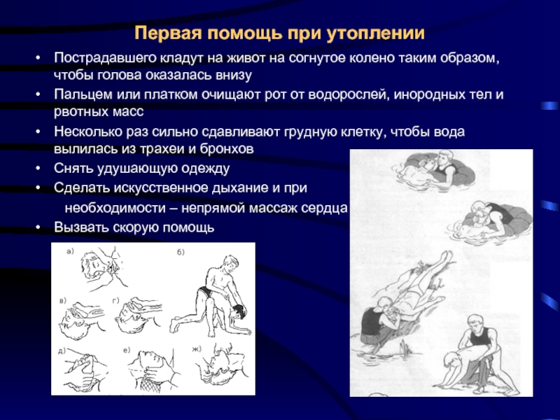 Оказание первой медицинской помощи при утоплении, особенности ситуации, основные меры