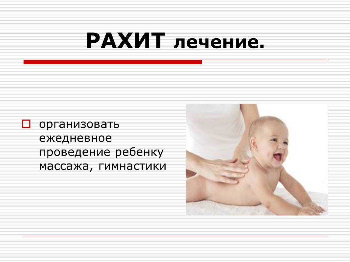 Ребенок Рахит Признаки Фото