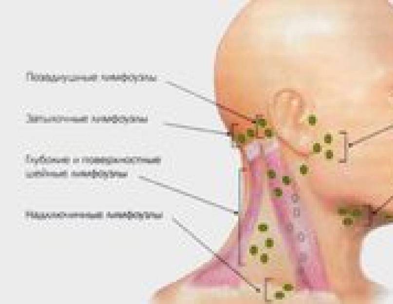 У ребенка увеличены лимфоузлы на шее: причины воспаления и лечение в домашних условиях