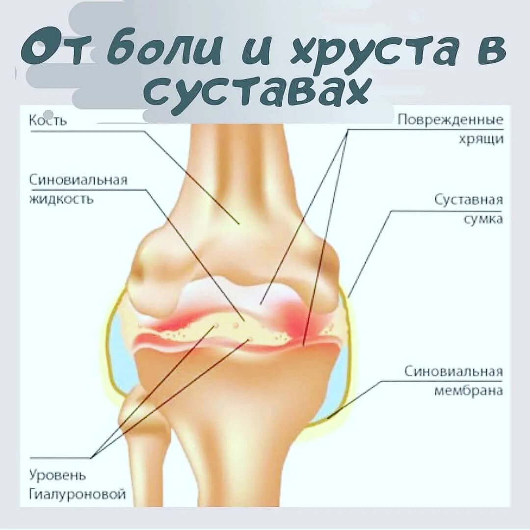 У грудничка хрустят суставы: причины хруста, лечение