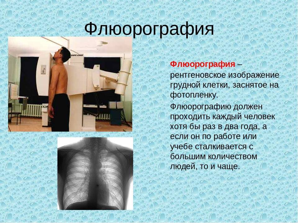 Для чего нужна флюорография мужа при беременности? полезная информация для беременных.