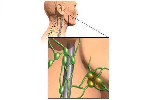 Воспаленные лимфоузлы в паху картинки
