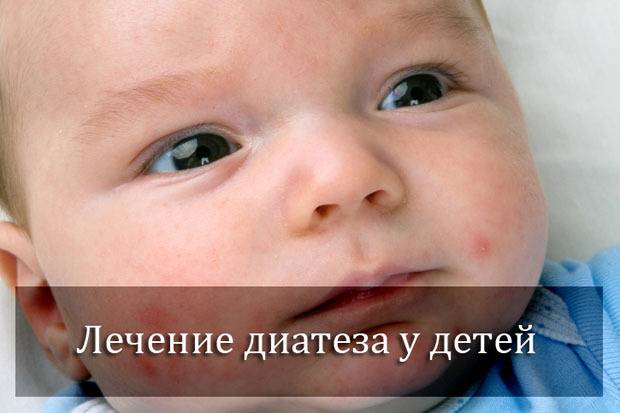 Пищевая аллергия на щеках у новорожденных: чем лечить крапивницу | nutrilak