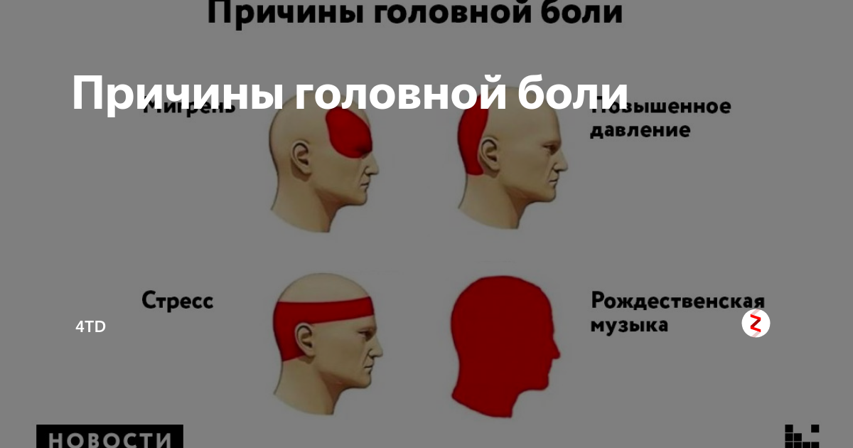 Сильная головная боль в области висков. Локализация головной боли и причины. Болит голова. Головная боль части головы. Болит голова вэ.