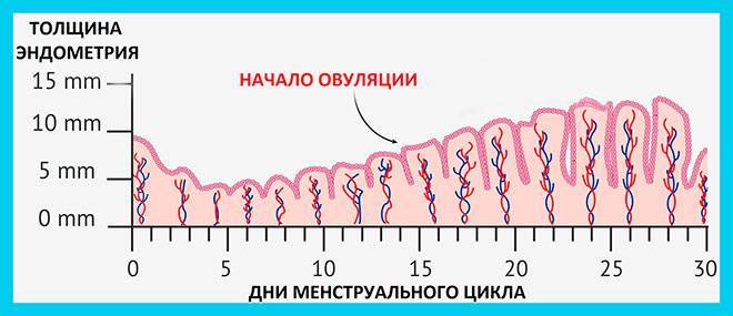 Эндометриоз: можно ли забеременеть