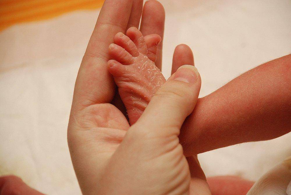 Почему облазит кожа на пальцах рук и ног у ребенка и взрослого | узнавай.онлайн