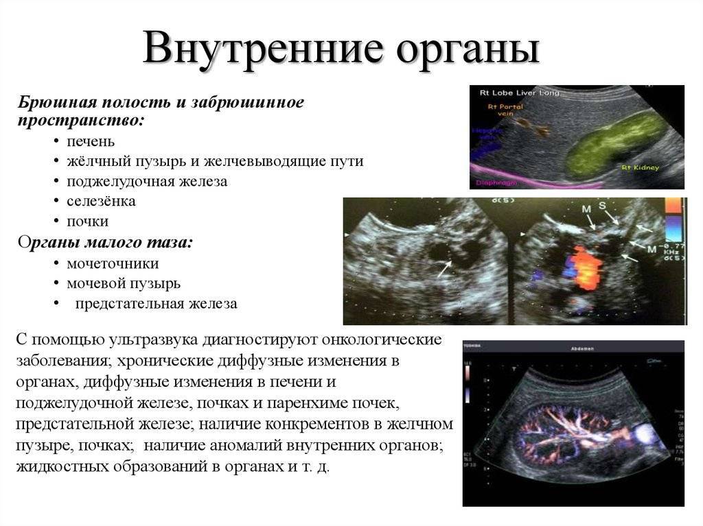 Хронический панкреатит: обострение, причины, симптомы, диагностика и лечение хр панкреатита
