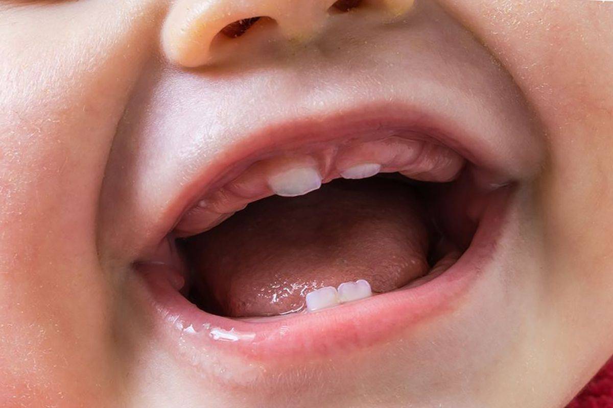 Режутся зубки и клыки: как понять и что делать