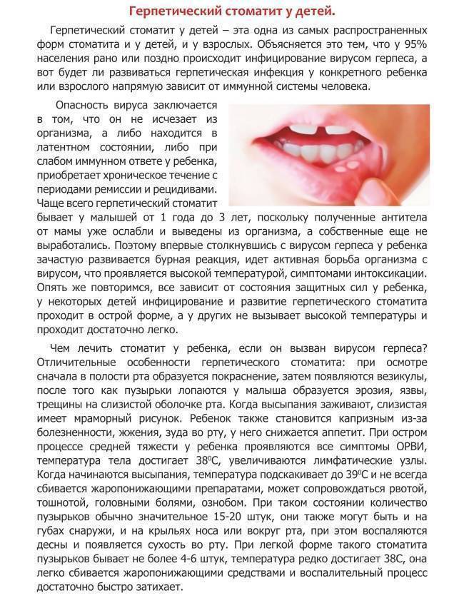 Стоматит на губе у ребенка: лечение, фото высыпаний во рту, симптомы