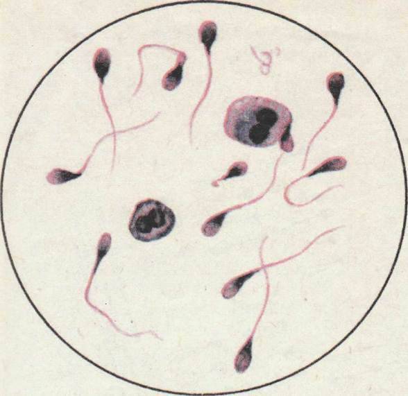 Спермограмма, сперматограмма, спермиограмма, спермокинезиограмма: исследование и интерпретация результатов