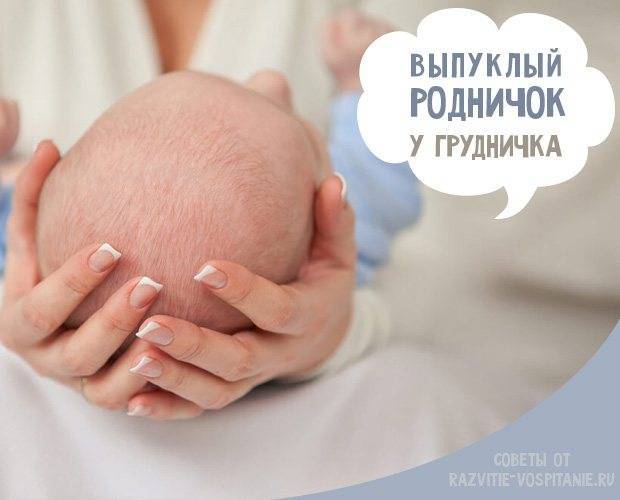 Роднички у новорожденных: что является нормой и что должно насторожить?