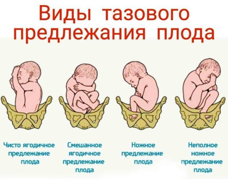 Ребенок при рождении видит перевернутое изображение