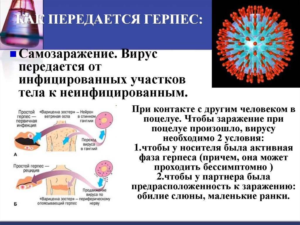 Вирусы герпеса: клиническая картина, лечение и профилактика | eurolab | инфекционные болезни