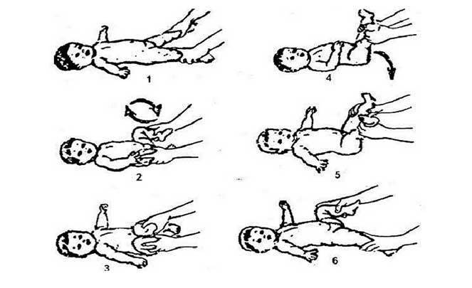 8 упражнений (лфк) при дисплазии тазобедренных суставов у детей