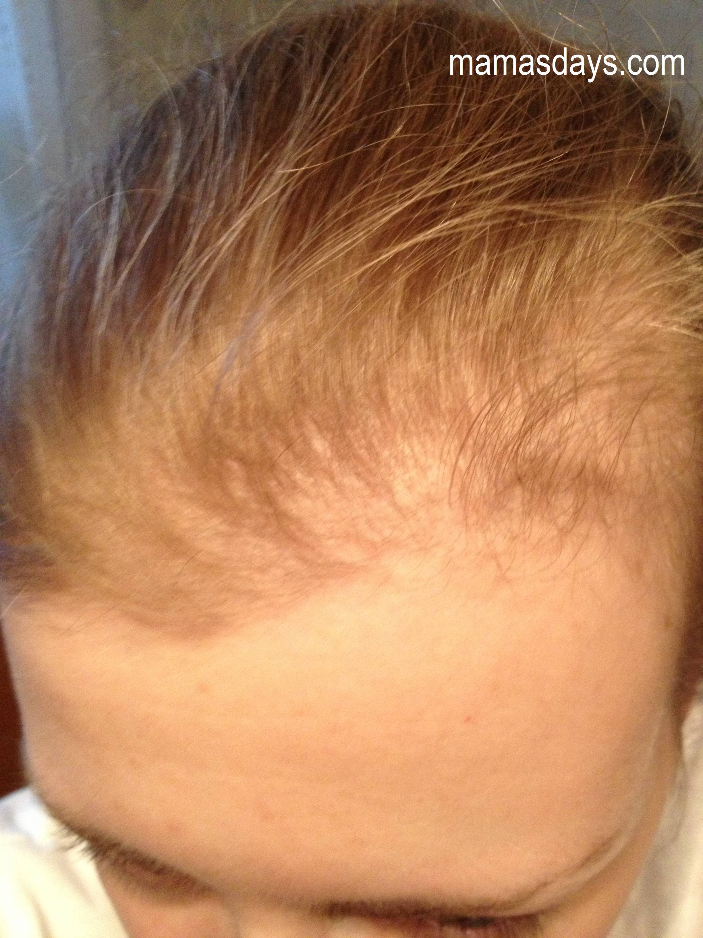 Выпадение волос в первые месяцы после родов: причины и методы борьбы