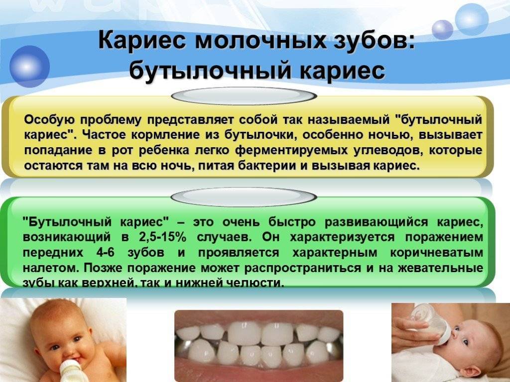 Кариес молочных зубов |